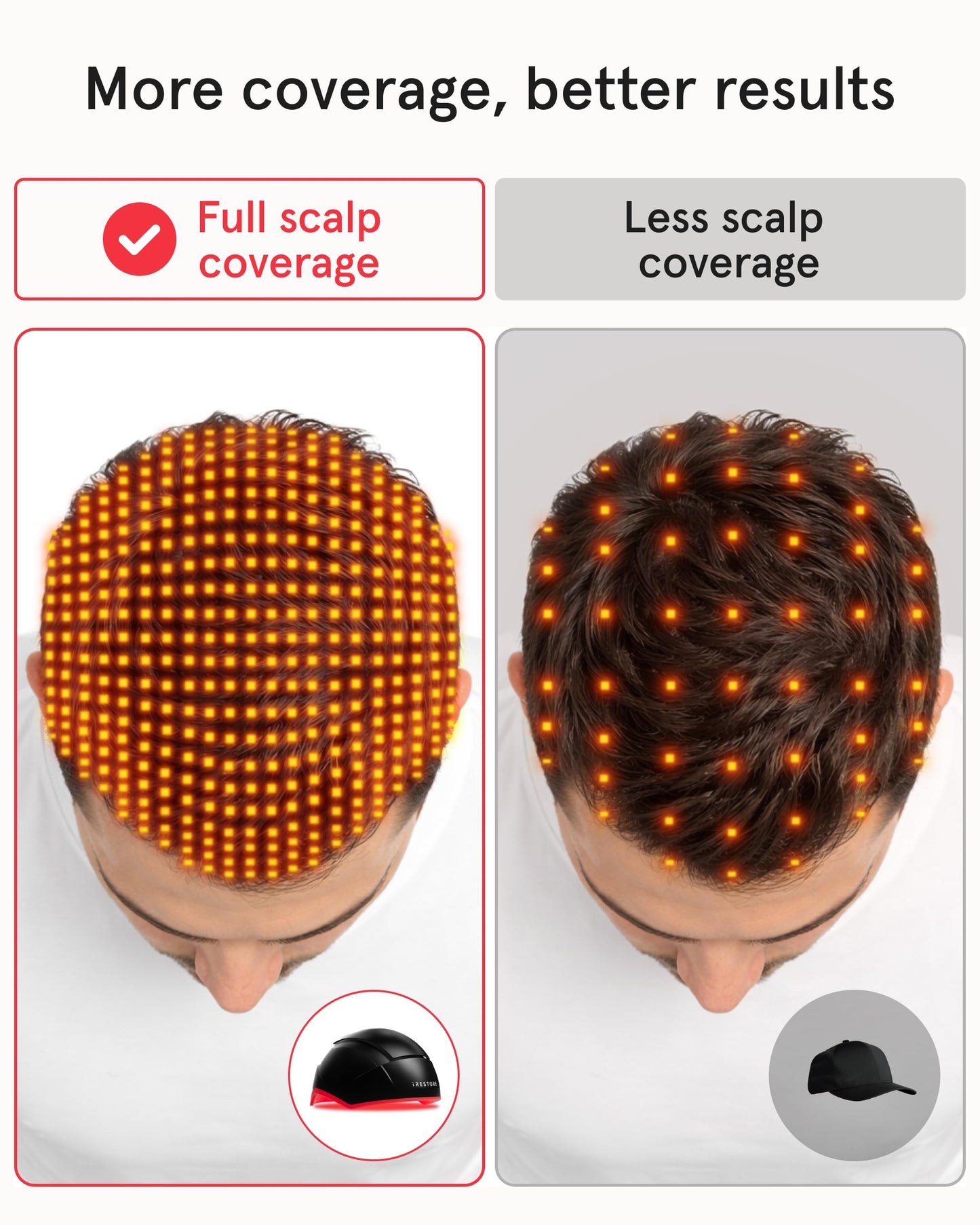 iRestore Elite - Laser Red Light Therapy for Hair Growth System - FDA Cleared Hair Loss, Hair Thinning & Alopecia Treatment for Men & Women - Laser Cap for Hair Regrowth Stimulates Denser Fuller Hair