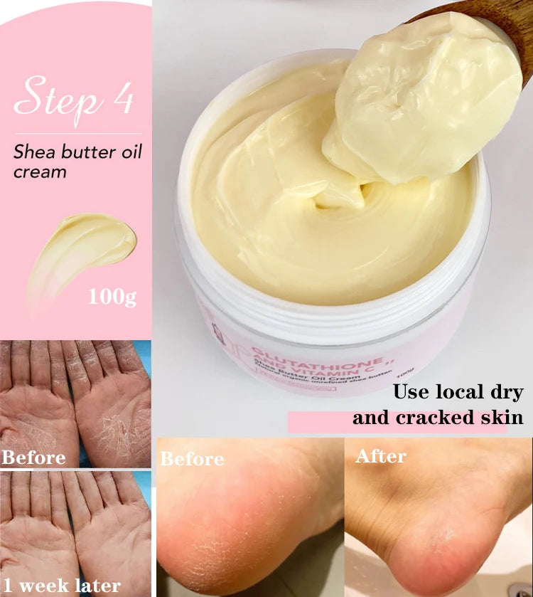 Whitening Skin Care Cream, Lightening Lotion, Remove Dark Spots