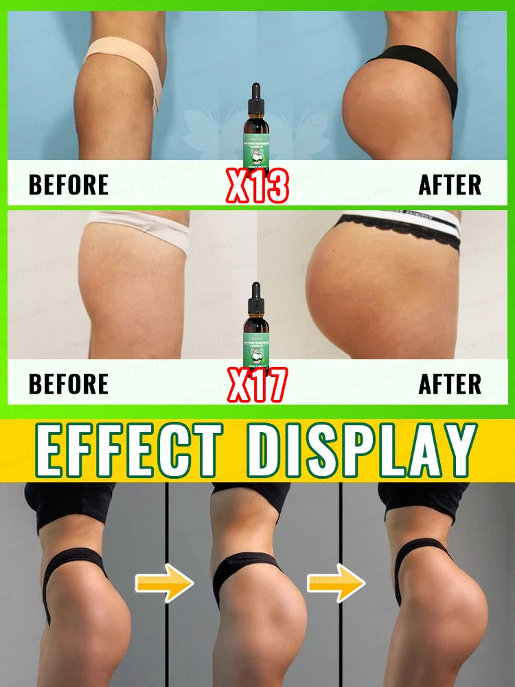 Beautiful buttocks, Enlargement