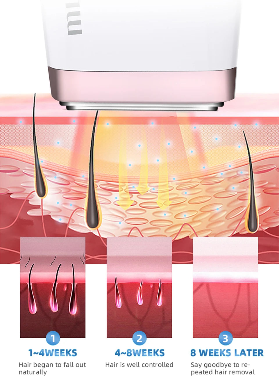 Laser Handheld Hair Removal Machine Ice Cool Permanent Face & Body