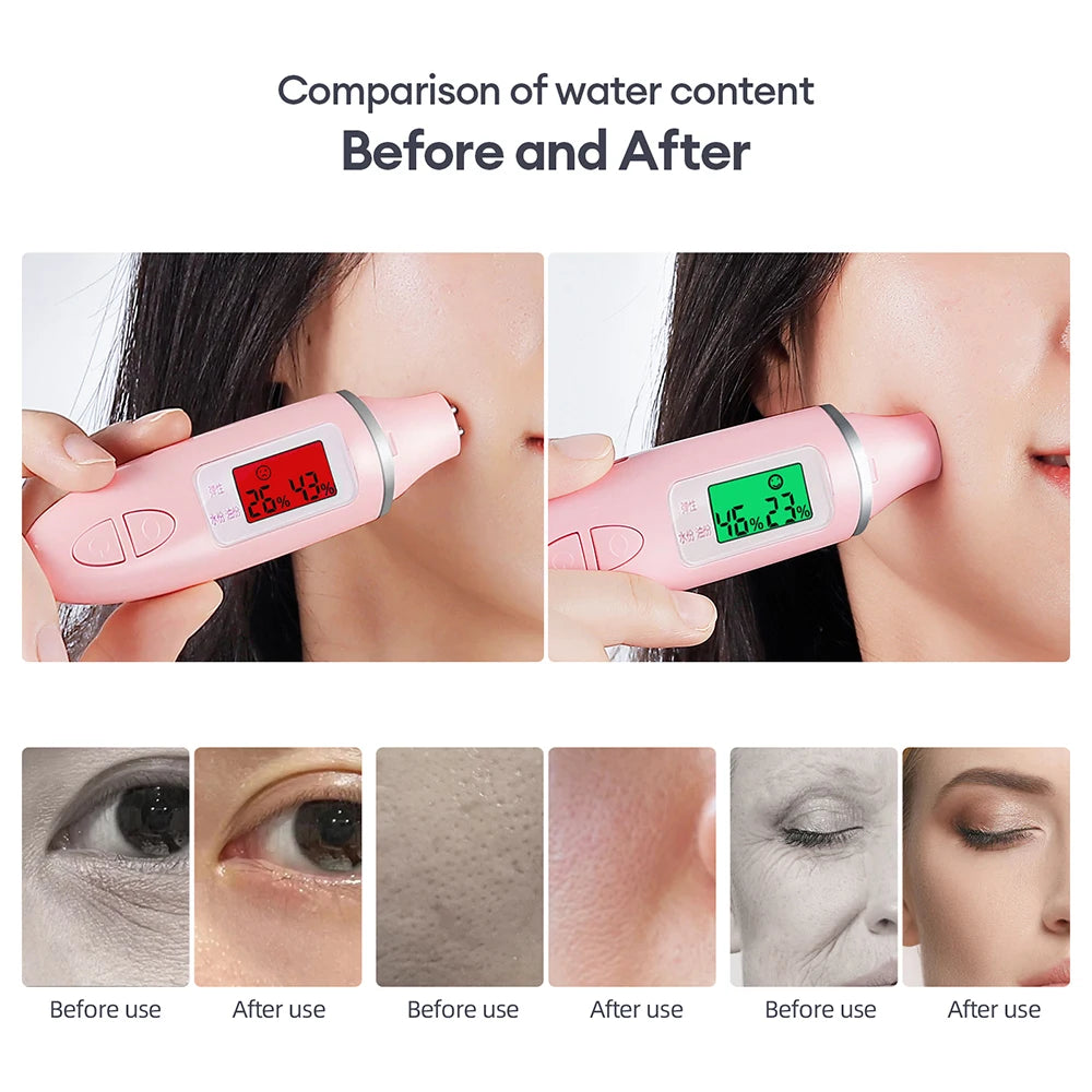 CO2 Oxygen Bubble Pen 5 Gear Vibration Oxygen Bubble Beauty Tool