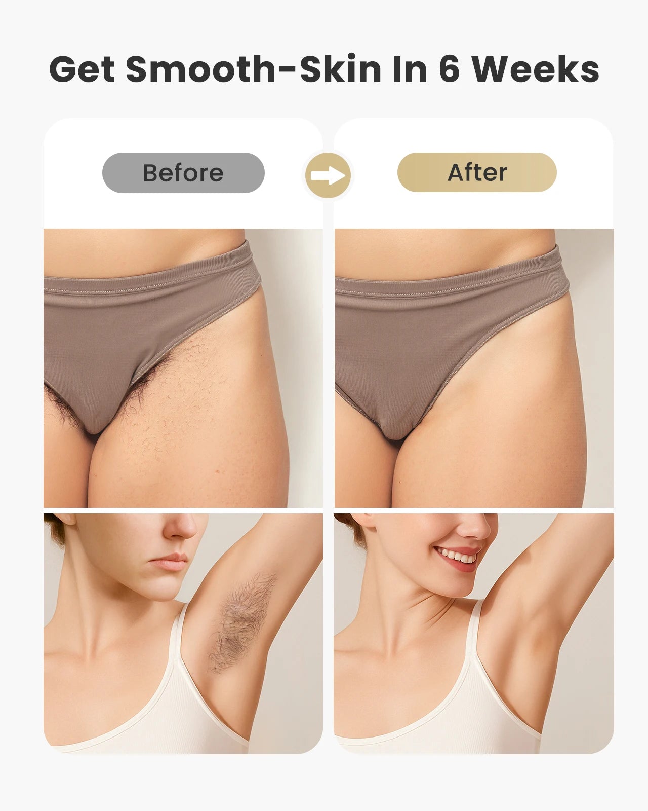 Laser Hair Removal Permanent Hair Remover