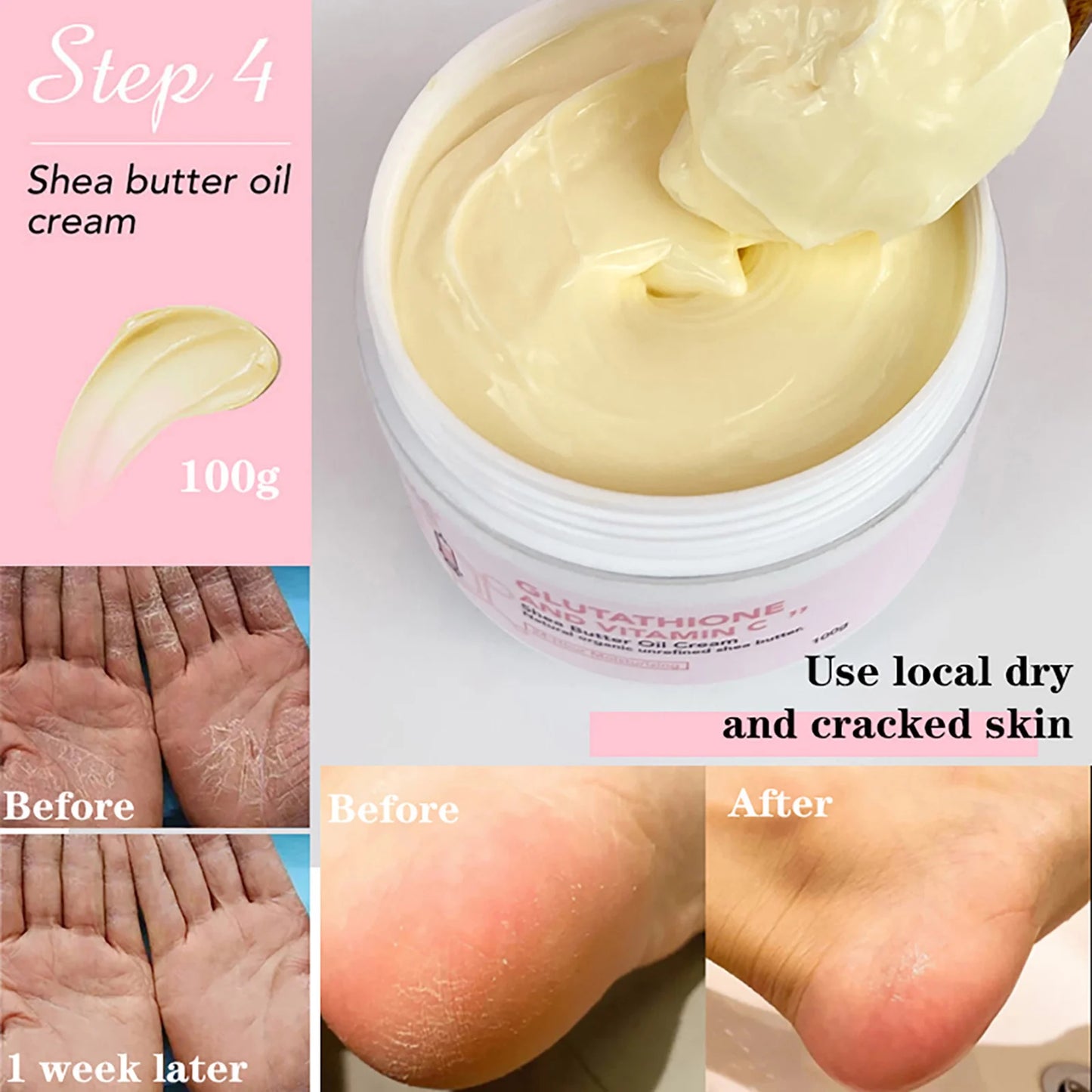 Whitening Skin Care Cream, Lightening Lotion, Remove Dark Spots